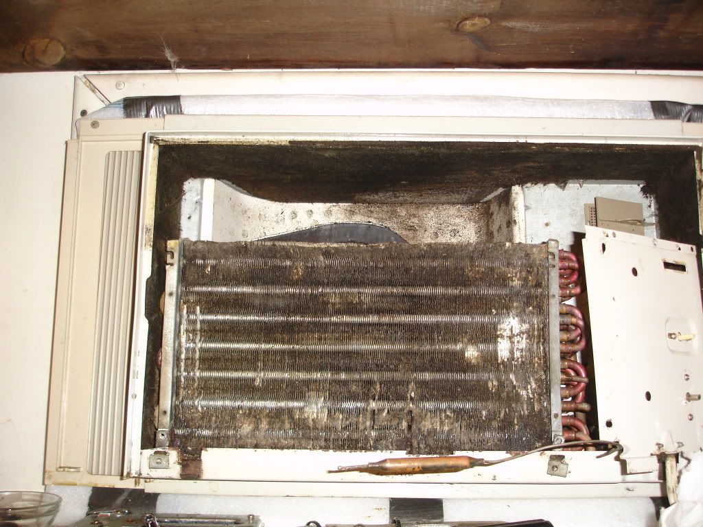 Sudden onset of Floaters Degenerative Vitreous